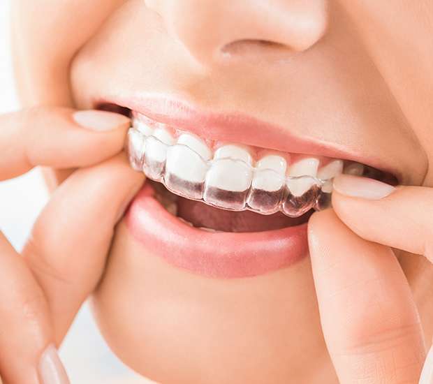 Brentwood Does Invisalign Really Work